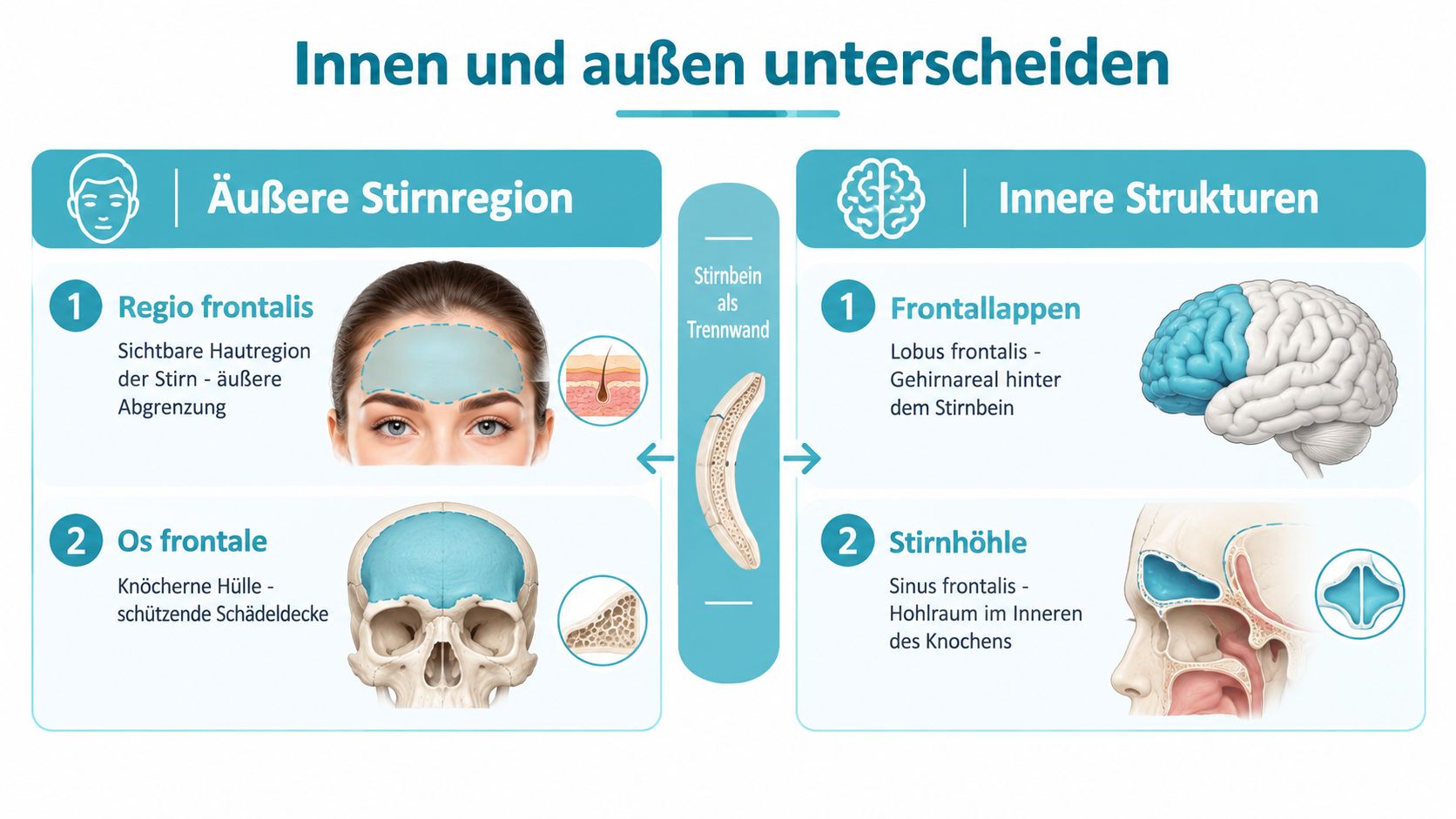 Infografik zur Unterscheidung zwischen der äußeren Stirnregion und den inneren Strukturen hinter dem menschlichen Stirnbein.